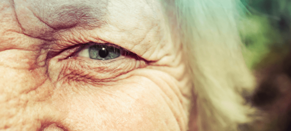 Abril Marrom: entenda as principais causas da perda de visão e como evitar complicações&nbsp;oculares